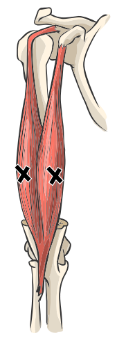 Biceps brachii of tweehoofdige bovenarmspier
